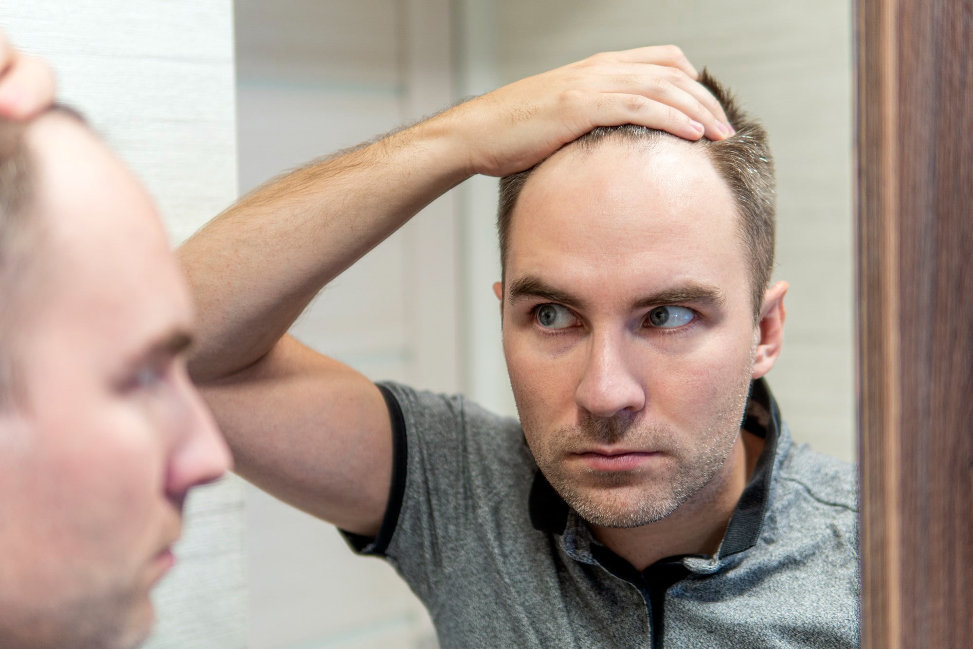 De mogelijke bijwerkingen van finasteride: waar moet je op letten voordat je begint?